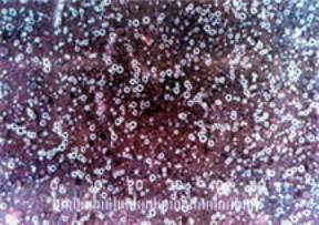 Water droplets in fuel